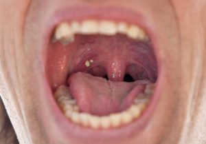 Read more about the article GOMILA LJUDI U USTIMA IMA OVU ODVRATNU STVAR: Stvara loš zadah, a evo kako ga se možete riješiti!