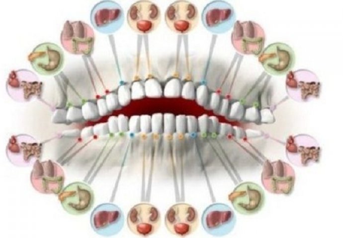 Read more about the article Svaki zub je povezan sa nekim organom u tijelu: Bol u zubu predviđa probleme pojedinog organa!