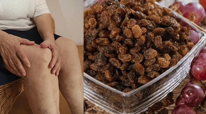 Read more about the article MNOGIMA JE POMOGAO – PROBAJTE: Za Samo 1 Mjesec Potpuno Obnovlja Kosti, Tetive, Ligamente, Zglobove…